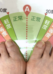 施術後
