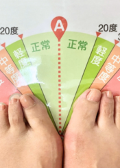 施術前