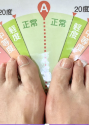 施術後